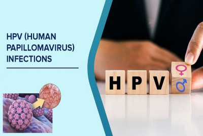 ویروس پاپیلومای انسانی (HPV) و نقش آن در سرطان‌های زنان