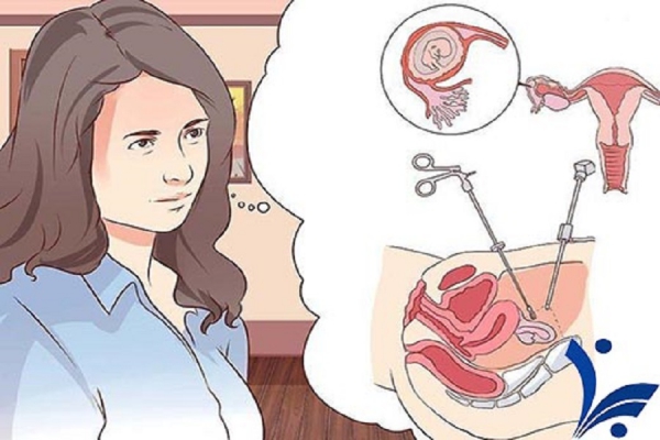 همۀ آنچه باید دربارۀ بارداری خارج‌‌رحمی بدانید!
