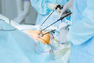 برگزاری سومین کنگره بین‌المللی اندومتریوز و جراحی کم‌تهاجمی زنان