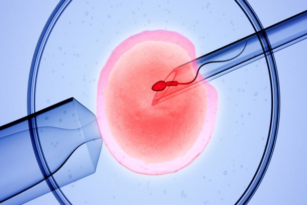 مراحل انجام IVF یا ICSI (میکرواینجکشن)