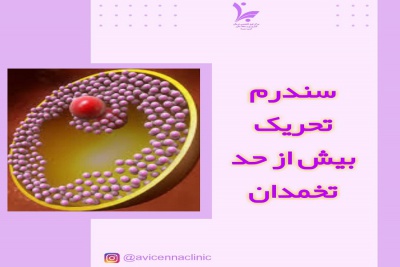 سندرم تحریک بیش از حد تخمدان