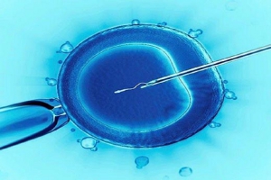 تزریق اسپرم به داخل سیتوپلاسم تخمک (ICSI) چیست؟