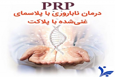  بازیابی توان باروری با پلاسمای غنی‌شده با پلاکت (PRP)